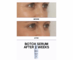 Botox Serum Bee Venom 30 mL - Image 