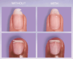 Essie Nail Repair Patch - Image 