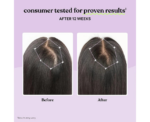 Lemme Grow Hair And Scalp Supplement For Women - Image 