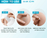 Garnier Invisible Pimple Patch - Image 