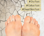 APIEU Foot Peeling Socks - Image 
