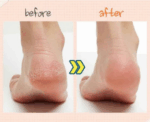 APIEU Foot Peeling Socks - Image 