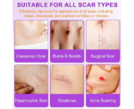Scar Treatment Silicone Tape - Image 