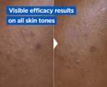 Niacinamide Bright Cream Tone Correcting and Hydrating Body Care - Image 