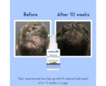 WishCare Hair Growth Serum Concentrate - Image 