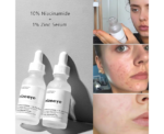 Niacinamide Face Serum - Image 