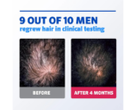 Mens Rogaine Hair Regrowth Foam Treatment - Image 
