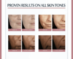 Dual Serum for Dark Spots and Anti Aging - Image 