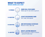 Mens Rogaine Hair Regrowth Foam Treatment - Image 