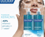 Acne Foaming Cleanser - Image 