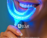 Ecla E20 Bionic Professional Teeth Whitening Kit - Image 