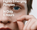 Pimple Clear Acne Spot Patches 24 Count - Image 