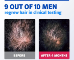 Regaine For Men Extra Strength Scalp Foam - Image 