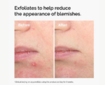 The Ordinary Salicylic Acid 2% Solution - Image 