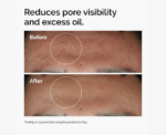 The Ordinary Niacinamide 10% + Zinc 1% Serum - Image 