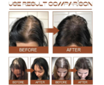 Soug Batana Hair Growth Natural Oil - Image 