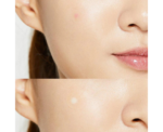 Cosrx Acne Pimple Master Patch - Image 