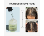 Rosemary Elixir Natural Hair Loss Solution - Image 
